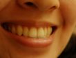 Zdrowe zęby- o tym warto wiedzieć 6