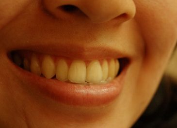 Zdrowe zęby- o tym warto wiedzieć 1